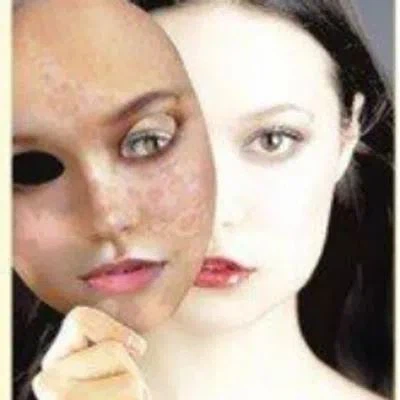 Monobenzone Powder Functions